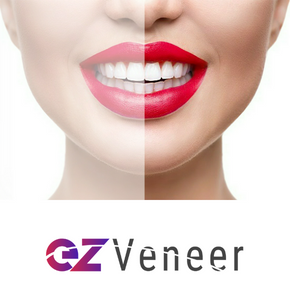 EZ Veener Dental Service in Dubai